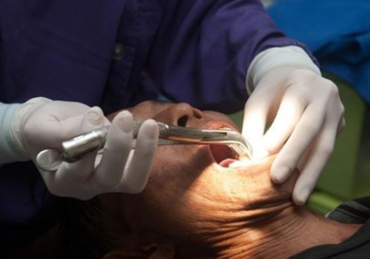 什么是根管治疗？根管后的牙齿能用多久